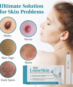 DAFEILA® LumeSkin Mole and Wart Removal Laser Pen