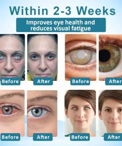 Jaxvolt™ Clarity Care Advanced Eye Drops