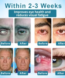 Jaxvolt™ Clarity Care Advanced Eye Drops