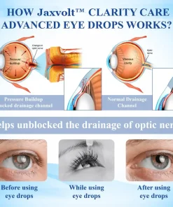 Jaxvolt™ Clarity Care Advanced Eye Drops