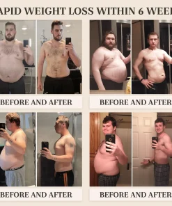 LYYETO® 𝐆𝐋𝐏-𝟏 𝐌𝐨𝐫𝐢𝐧𝐠𝐚 𝐒𝐥𝐢𝐦𝐦𝐢𝐧𝐠 & 𝐇𝐞𝐚𝐥𝐭𝐡 𝐁𝐨𝐨𝐬𝐭 𝐃𝐫𝐨𝐩𝐬