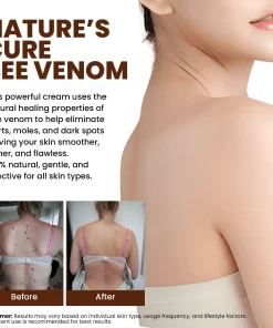 Lyyeto® Bee Venom Skin Treatment Cream