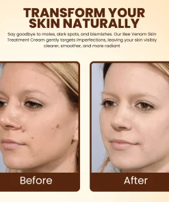 Lyyeto® Bee Venom Skin Treatment Cream