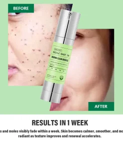 NEGUSY® USA DermaClear Reedle Shot 100 Wart & Mole Eraser Serum