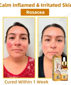 ODEIUN™ BOTOX Bee Venom Anti-Aging Serum