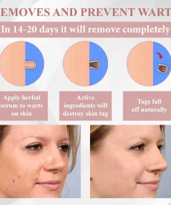 ODEIUN® Tag & Blemish Peel-Off Gel Wrapping Mask