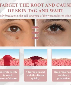 ODEIUN® Tag & Blemish Peel-Off Gel Wrapping Mask