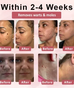 ODEIUN® Tag & Blemish Peel-Off Gel Wrapping Mask