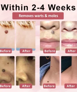 ODEIUN® Tag & Blemish Peel-Off Gel Wrapping Mask