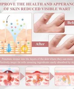 ODEIUN® Tag & Blemish Peel-Off Gel Wrapping Mask