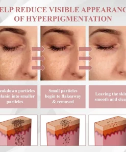 ODEIUN® Tag & Blemish Peel-Off Gel Wrapping Mask