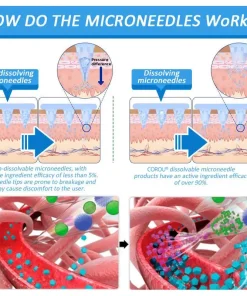 СΟRΟU® GLP-1 Nаnо Mісrоnееdlе Раtсh