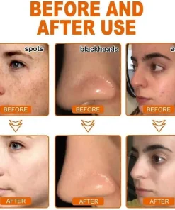 Slimoly™ Whitening and Freckle - Removing Mask