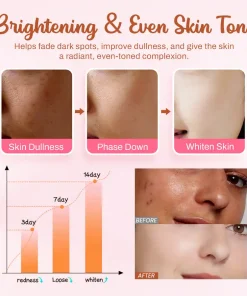 Slimoly™ Whitening and Freckle - Removing Mask