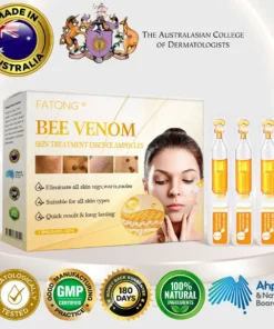 𝑭𝑨𝑻𝑶𝑵𝑮® 𝑩𝒆𝒆 𝑽𝒆𝒏𝒐𝒎 𝑺𝒌𝒊𝒏 𝑻𝒓𝒆𝒂𝒕𝒎𝒆𝒏𝒕 𝑬𝒔𝒔𝒆𝒏𝒄𝒆 𝑨𝒎𝒑𝒐𝒖𝒍𝒆𝒔