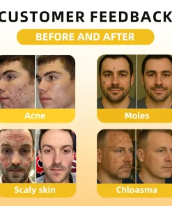 𝑭𝑨𝑻𝑶𝑵𝑮® 𝑩𝒆𝒆 𝑽𝒆𝒏𝒐𝒎 𝑺𝒌𝒊𝒏 𝑻𝒓𝒆𝒂𝒕𝒎𝒆𝒏𝒕 𝑬𝒔𝒔𝒆𝒏𝒄𝒆 𝑨𝒎𝒑𝒐𝒖𝒍𝒆𝒔