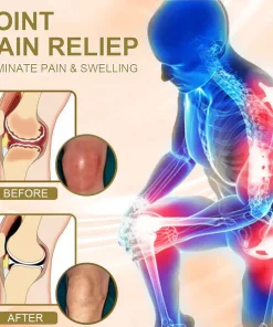 𝑹𝒂𝒊𝒏𝒅𝒆𝒘® 𝑩𝑬𝑬 𝑽𝑬𝑵𝑶𝑴 𝑱𝑶𝑰𝑵𝑻 𝑹𝑬𝑳𝑰𝑬𝑭 𝑩𝑨𝑳𝑴