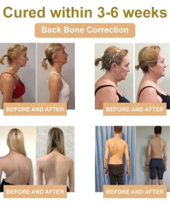 𝑹𝒂𝒊𝒏𝒅𝒆𝒘® 𝑩𝑬𝑬 𝑽𝑬𝑵𝑶𝑴 𝑱𝑶𝑰𝑵𝑻 𝑹𝑬𝑳𝑰𝑬𝑭 𝑩𝑨𝑳𝑴