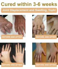 𝑹𝒂𝒊𝒏𝒅𝒆𝒘® 𝑩𝑬𝑬 𝑽𝑬𝑵𝑶𝑴 𝑱𝑶𝑰𝑵𝑻 𝑹𝑬𝑳𝑰𝑬𝑭 𝑩𝑨𝑳𝑴