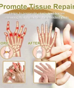 𝑹𝒂𝒊𝒏𝒅𝒆𝒘® 𝑩𝑬𝑬 𝑽𝑬𝑵𝑶𝑴 𝑱𝑶𝑰𝑵𝑻 𝑹𝑬𝑳𝑰𝑬𝑭 𝑩𝑨𝑳𝑴