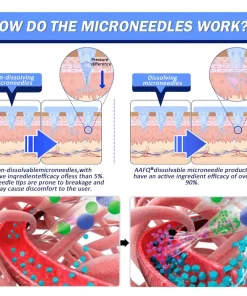 𝐀𝐀Ғ𝐐® 🛡️Nano Μicroneedle Patch with SΜGT-G L P 1 & Matrixyl 3000 – Slimming, Skin Tightening, Blood Sugar Support, No Injection