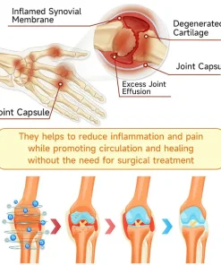 AQA™ Botulinum and Bee Toxin Pain Relief Bone Healing Cream