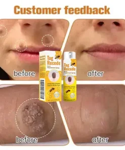 AQA™ TagRecede Bee Poison Treatment Spray