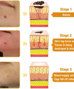 AQA™ TagRecede Bee Poison Treatment Spray