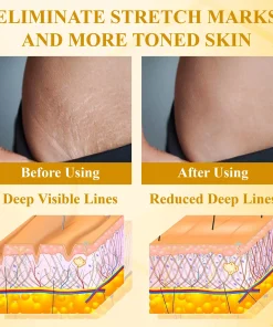 ApisDerm™ BotoxBee Advanced Multi-Action Firming Cream