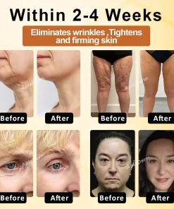 ApisDerm™ BotoxBee Advanced Multi-Action Firming Cream