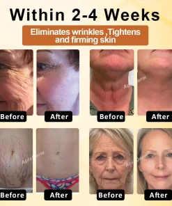 ApisDerm™ BotoxBee Advanced Multi-Action Firming Cream