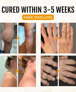 ArthriGone Magnesium Oil & Bee Venom Joint Care Spray