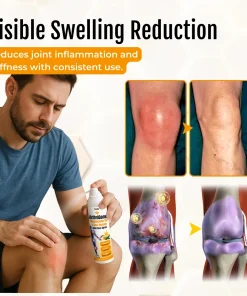 ArthriGone Magnesium Oil & Bee Venom Joint Care Spray