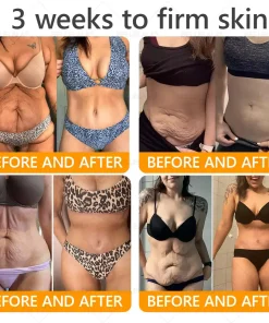 BELLELALA® BEE VENOM Wrinkle-Firming Multi-Purpose Cream