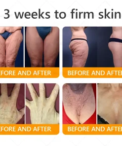 BELLELALA® BEE VENOM Wrinkle-Firming Multi-Purpose Cream