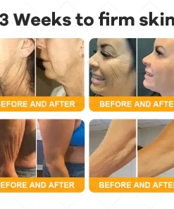 BELLELALA® BEE VENOM Wrinkle-Firming Multi-Purpose Cream