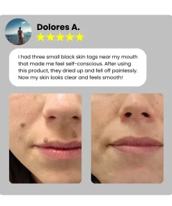 Dafeila® Shot Erase Pro