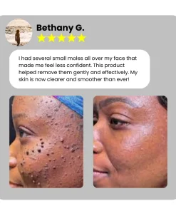 Dafeila® Shot Erase Pro