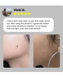 Dafeila® Shot Erase Pro