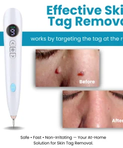 Dafeila® Shot Erase Pro