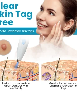 Dafeila® Shot Erase Pro