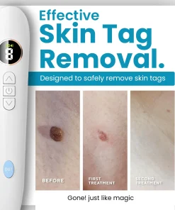 Dafeila® Shot Erase Pro