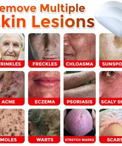 DermaPatchRX® MicroNeedle Botanic Skin Tag Removal Patch