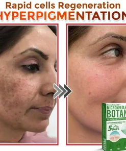 DermaPatchRX® MicroNeedle Botanic Skin Tag Removal Patch