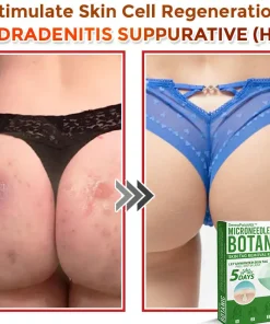 DermaPatchRX® MicroNeedle Botanic Skin Tag Removal Patch