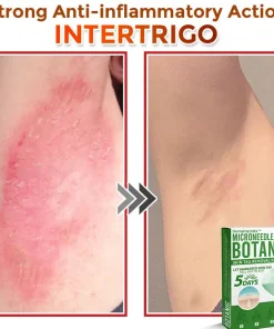 DermaPatchRX® MicroNeedle Botanic Skin Tag Removal Patch