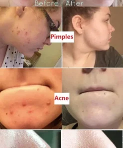 Grevéa™ Green Tea Deep Cleanse Mask Stick