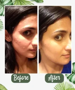 Grevéa™ Green Tea Deep Cleanse Mask Stick