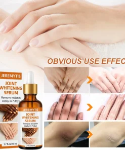 JEREMYTIS™ Joint Whitening Serum