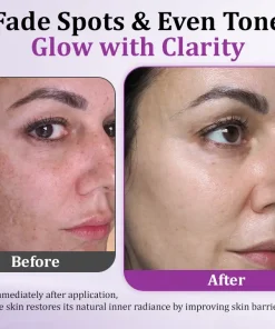 Juxek® MelantraX Advanced Anti-Hyperpigmentation Essence